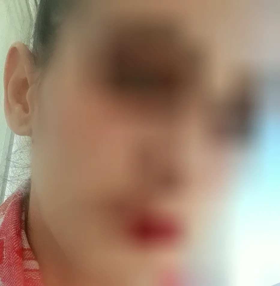Millie, 37